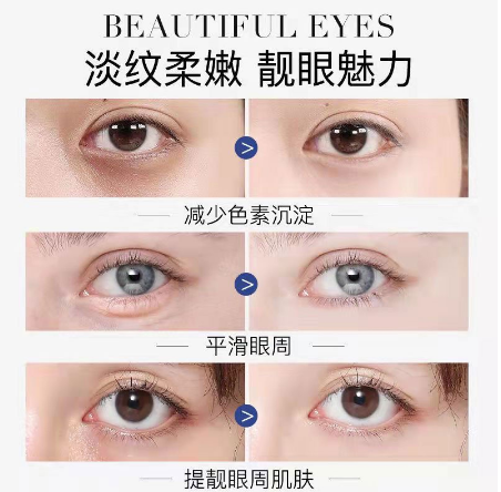 【台灣現貨】賣2發3 熱熔霜ana肌先知眼霜 淡化細紋 祛斑美白 熬夜淡化黑眼圈眼袋緊緻抗皺細紋去皺紋眼袋 【台灣現貨】賣2發3 熱熔霜ana肌先知眼霜 淡化細紋 祛斑美白 熬夜淡化黑眼圈眼袋緊緻抗皺細紋去皺紋眼袋