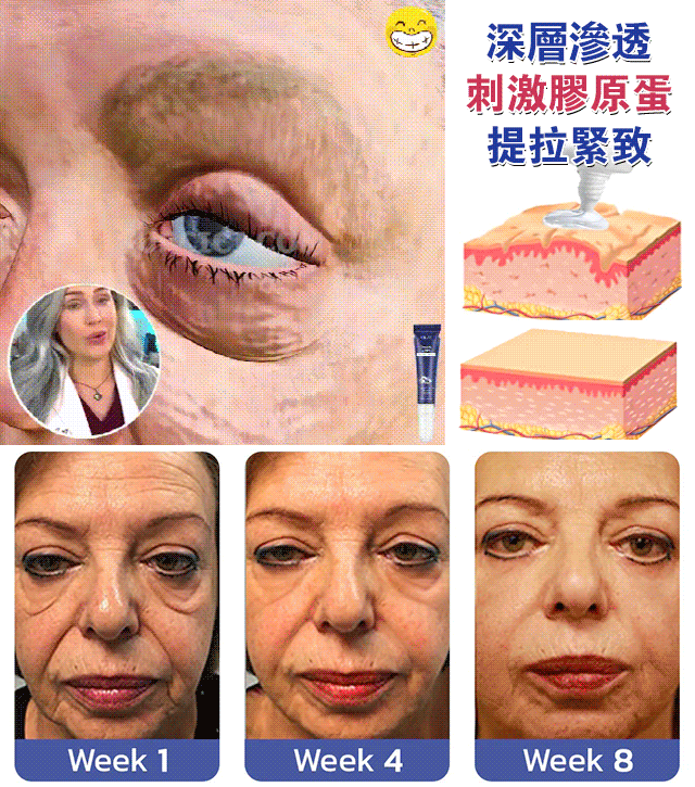 EELHOE 雙眼皮定型霜