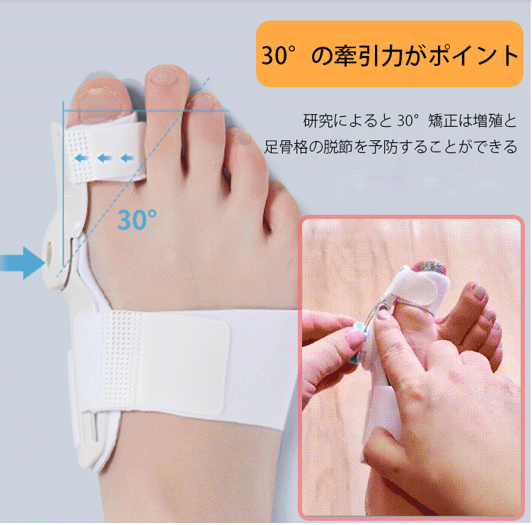 日本骨科醫生推薦】Tenicore獨家3D旋調整骨拇指外翻矯正器， 科學矯正不傷骨