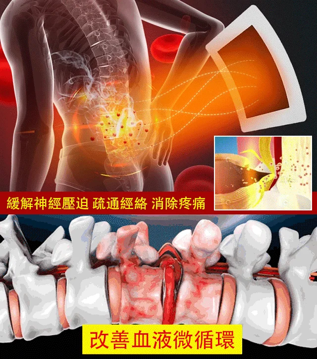 火爆熱銷中!坐骨神經腰間盤關節頸肩腰腿半月貼!1盒10貼,無任何副作用! 火爆熱銷中!坐骨神經腰間盤關節頸肩腰腿半月貼!1盒10貼,無任何副作用!